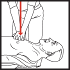Give chest compressions to the victim